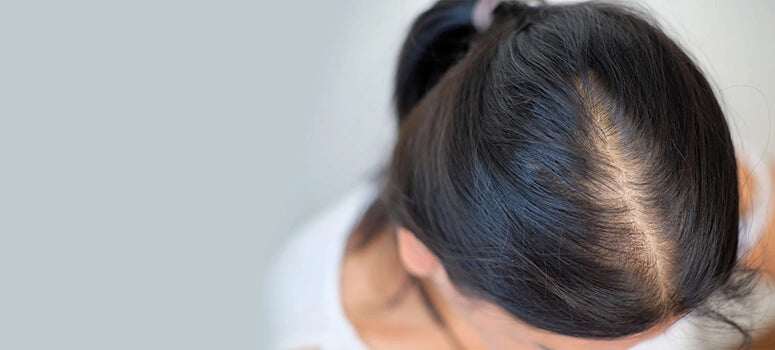 Hair Loss Category Header