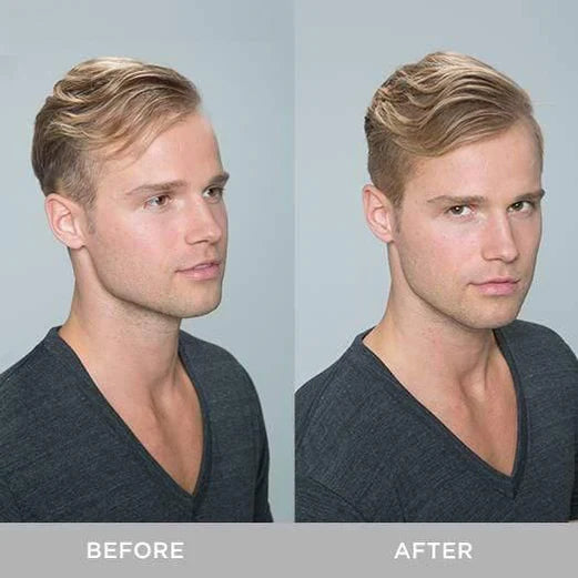 Toppik XFusion Keratin Hair Fibers image of male model before and after